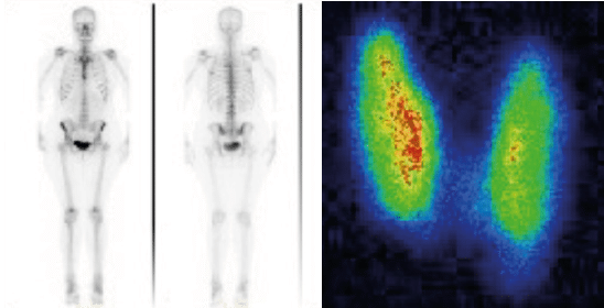 MI-Nuclear Medicine MI-Nuclear Medicine