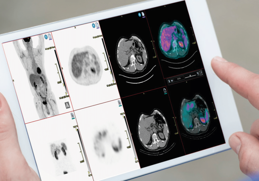 Molecular-Imaging-scan-ipad-web Molecular-Imaging-scan-ipad-web
