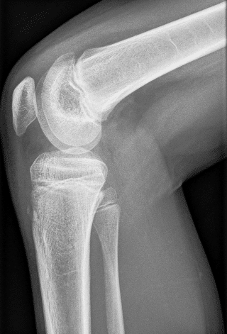 XERO orthopedics XERO orthopedics