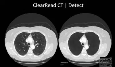 customer-references-ai-in-radiology-scan-1