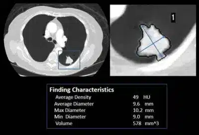 customer-references-ai-in-radiology-scan-2