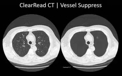 customer-references-ai-in-radiology-scan-3