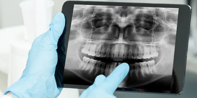 specialtyimaging-dental