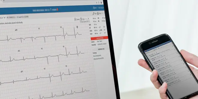 specialtyimaging-ecg